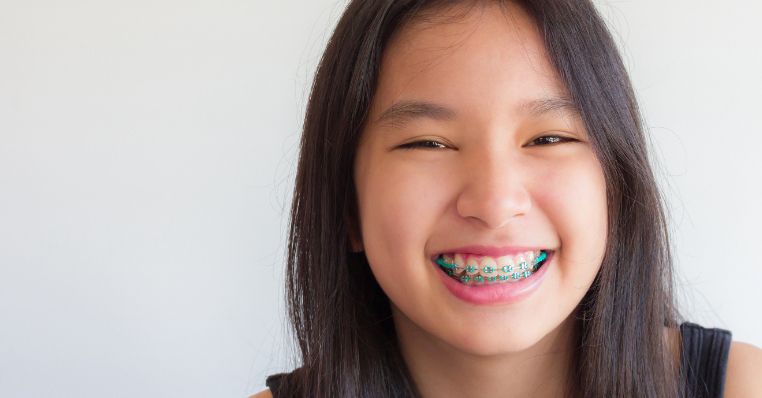 A boy with braces smiling