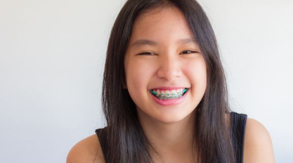 A girl with braces smiling
